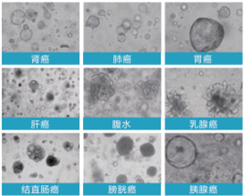 肾癌、肺癌、胃癌、肝癌、腹水、乳腺癌、结直肠癌、膀胱癌和胰腺癌患者来源肿瘤类器官