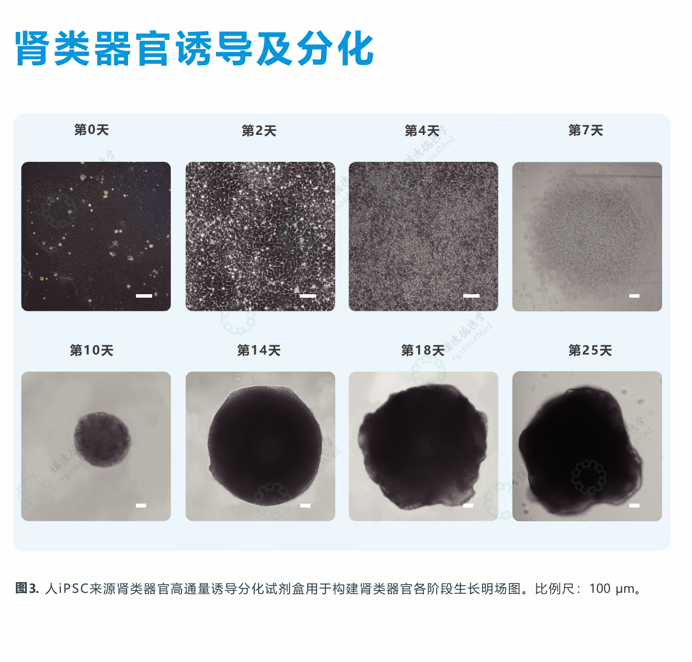 肾类器官各阶段生长明场图